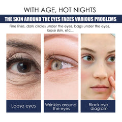 EELHOE Eye Repair Moisturizing Hydration Fade Eye Lines Repair Skin Eye Serum