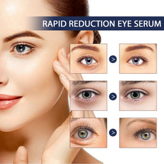 EELHOE Eye Repair Moisturizing Hydration Fade Eye Lines Repair Skin Eye Serum