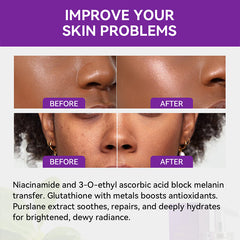 Dr. Roseva Dual Glutathione 24K