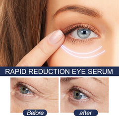 EELHOE Eye Repair Moisturizing Hydration Fade Eye Lines Repair Skin Eye Serum